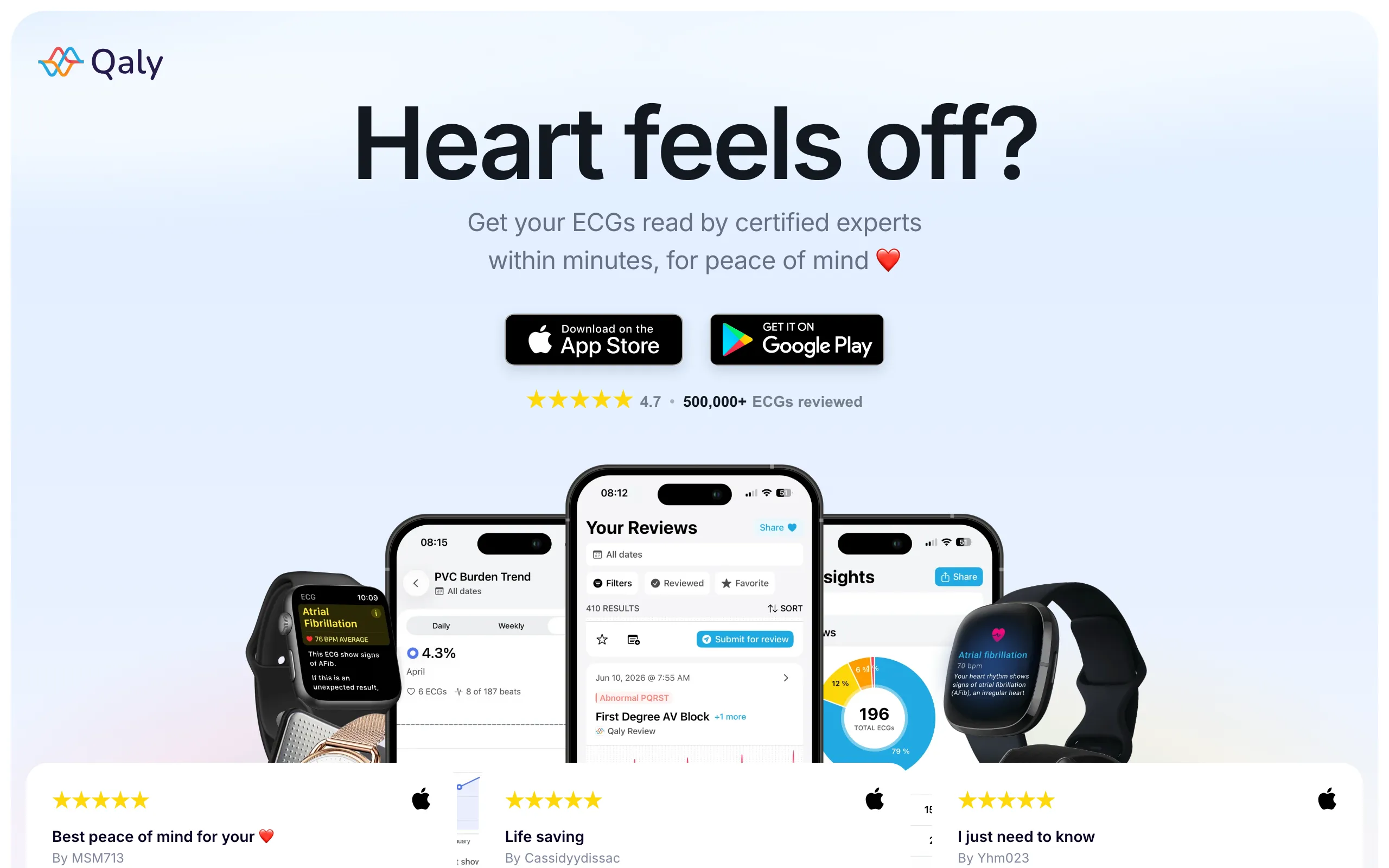 Screenshot of Qaly | ECG Reader - 500,000+ ECGs Analyzed